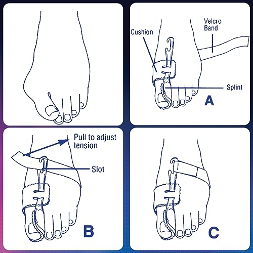 PediFix Nighttime Bunion Regulator, Left, Medium